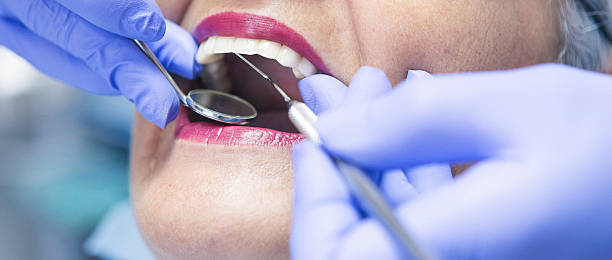Best Emergency Wisdom Tooth Extraction in Fort Walton Beach, FL